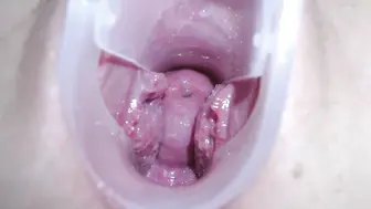 能清晰的看到子宫